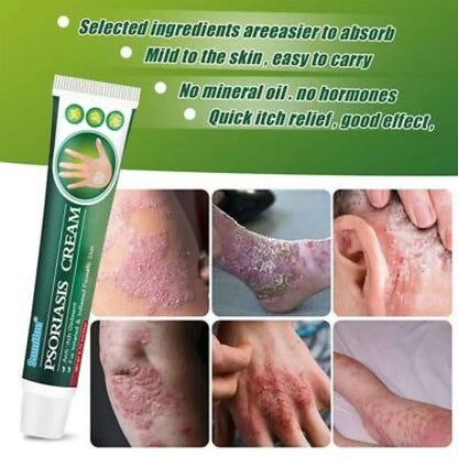 Psoriasis Cream (Original) – 20g
